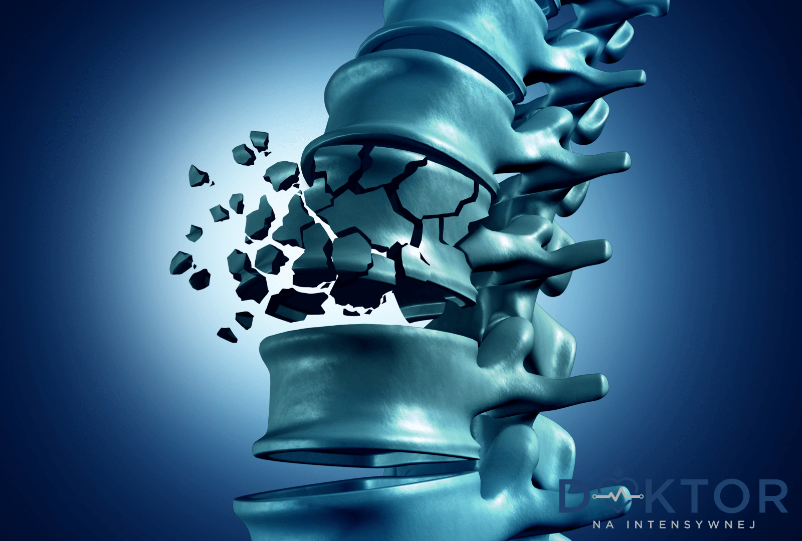 uszkodzenie rdzenia kręgowego