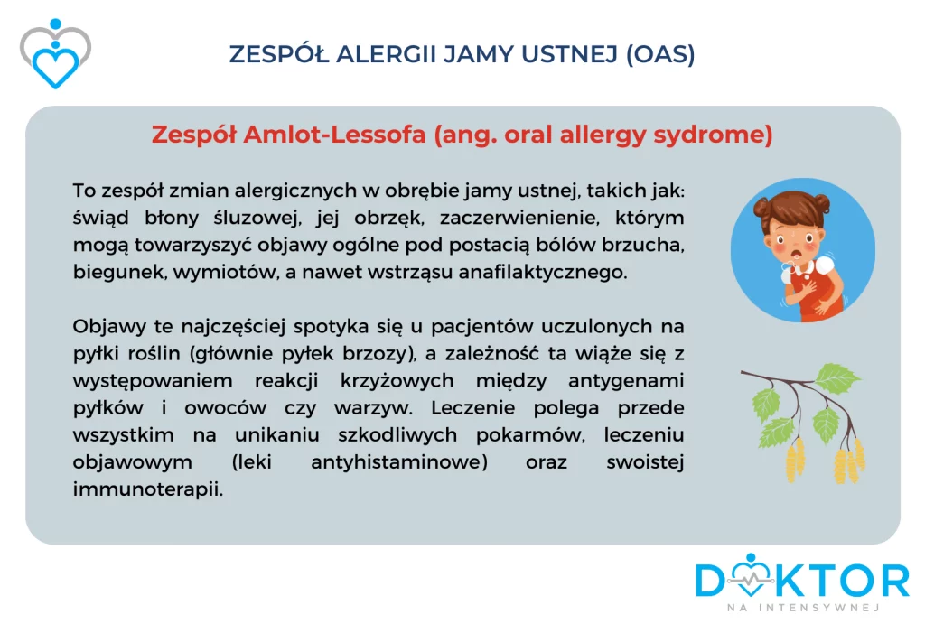 Zespół alergii jamy ustnej, anafilaksja, doktor na intensywnej